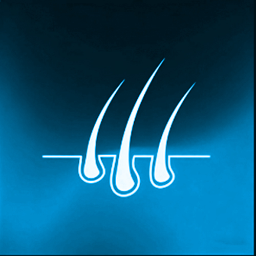 Implanted human hair [+€285]